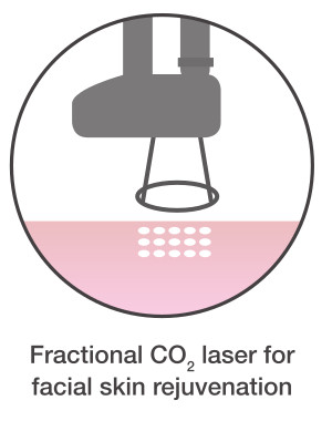 fractional co2 laser
