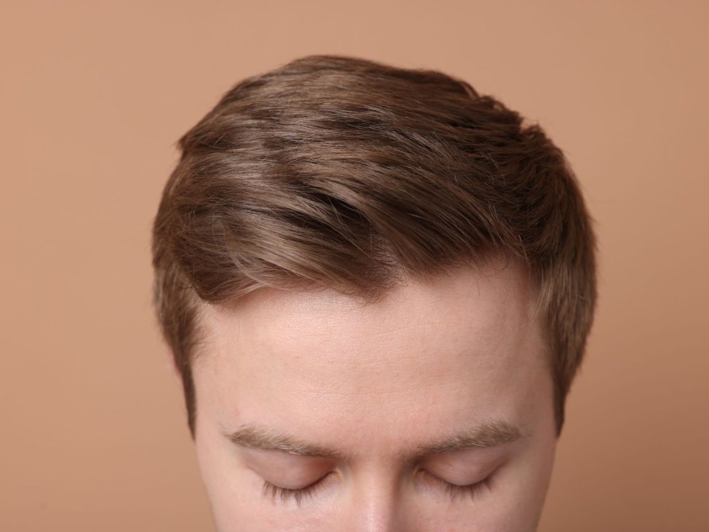 Growth factor scalp treatment Bradford