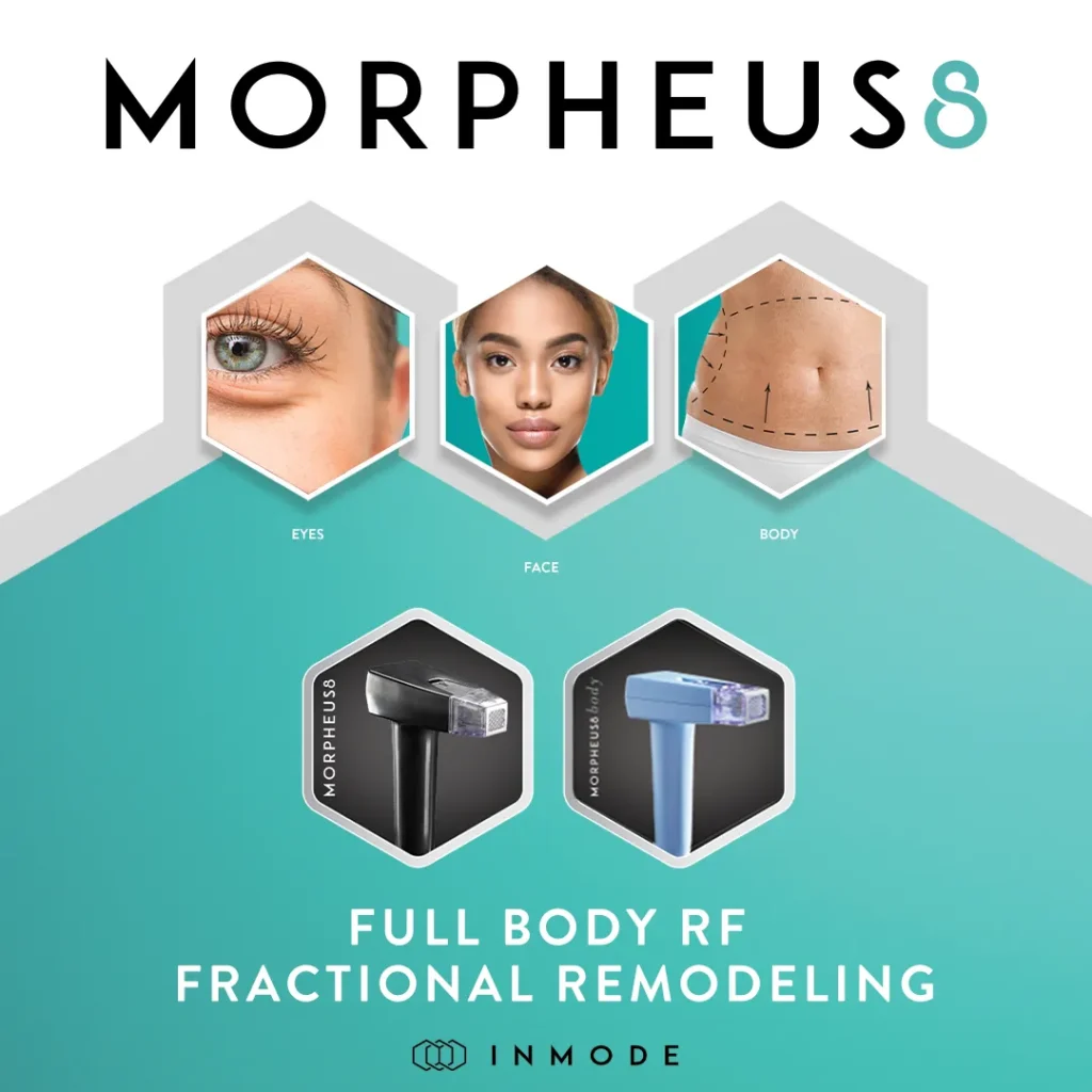 Morpheus8 microneedling RF