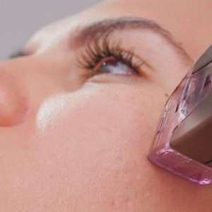 Morpheus8 - Microneedling with Radiofrequency - Arden Clinic