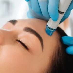 HydraFacial Elite - Deep Cleanse, Hydrate and Glow - Arden Clinic