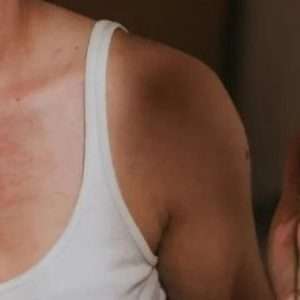 Skin Tag and Mole Removal Treatment - Arden Clinic