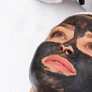 Laser carbon facial also known as Hollywood Peel in Bradford
