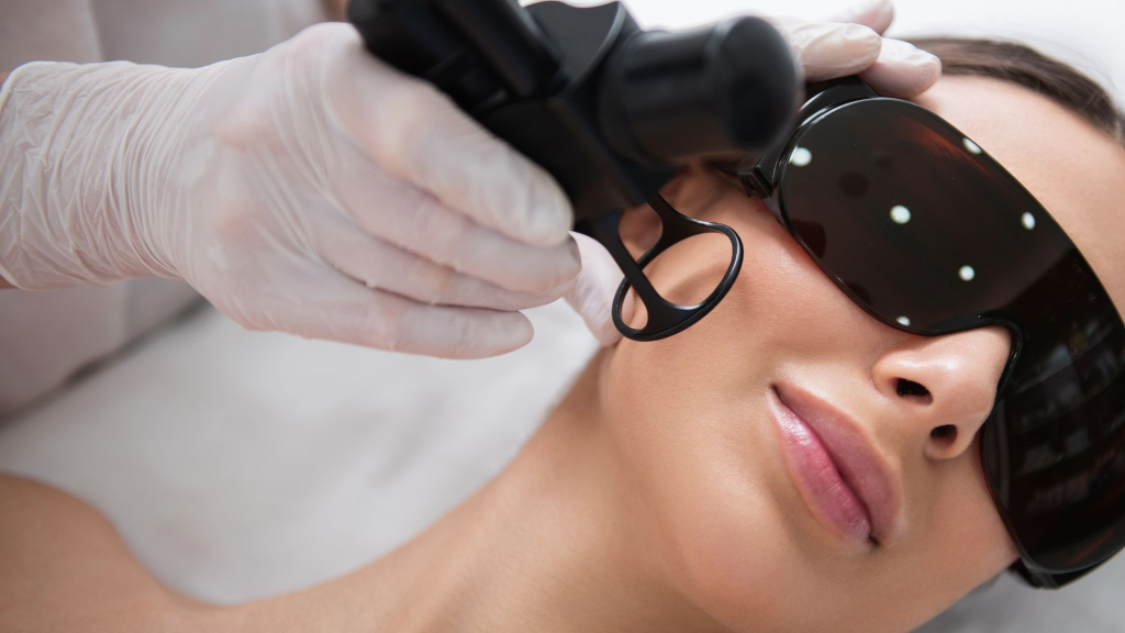 Melasma Laser treatment in Bradford