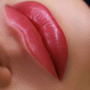 Laser Lip Depigmentation Bradford