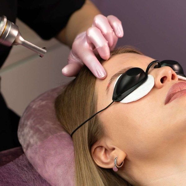 Eyebrow tattoo removal
