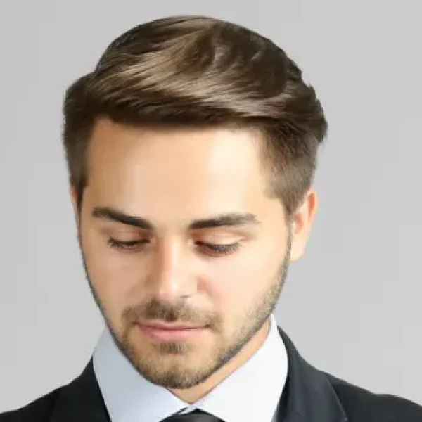 Hair Restoration 4