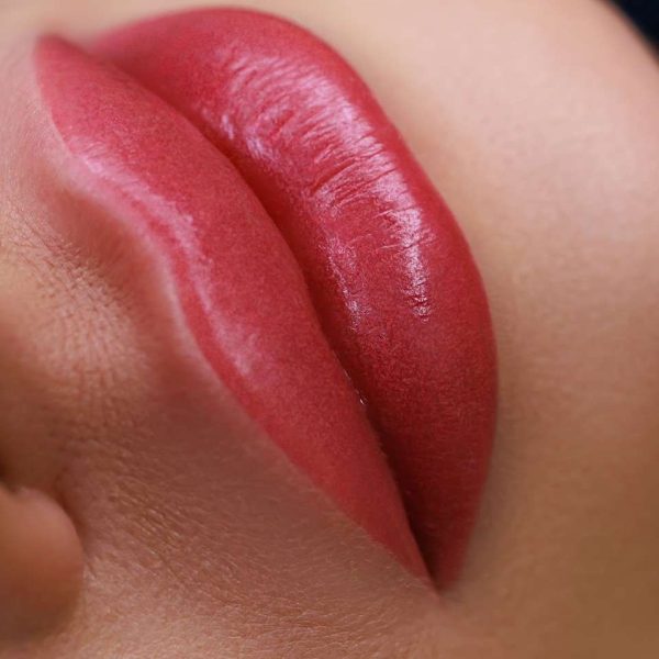 Laser Lip Depigmentation Bradford