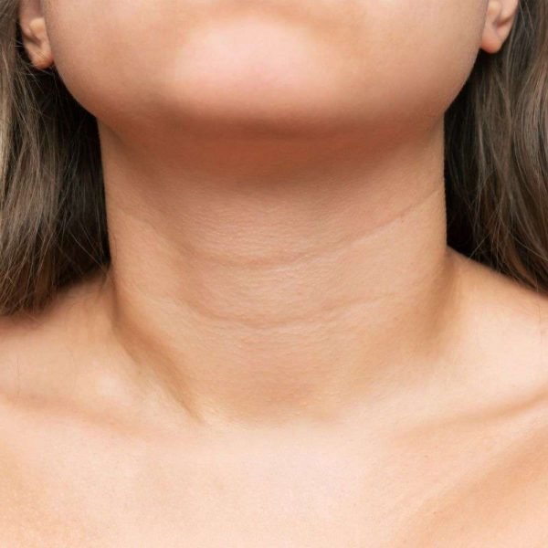Neck