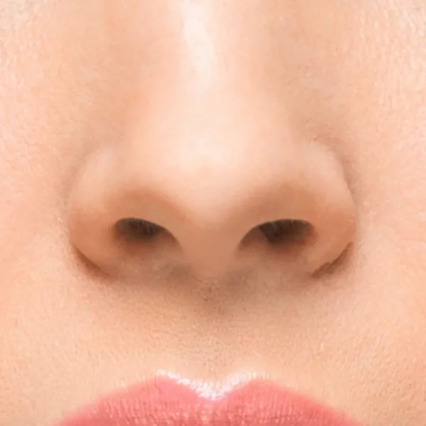 nose filler