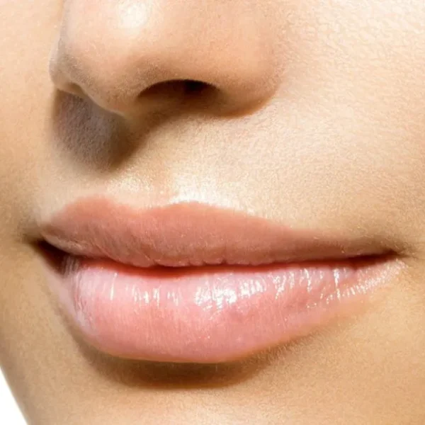 upper lip hair removal